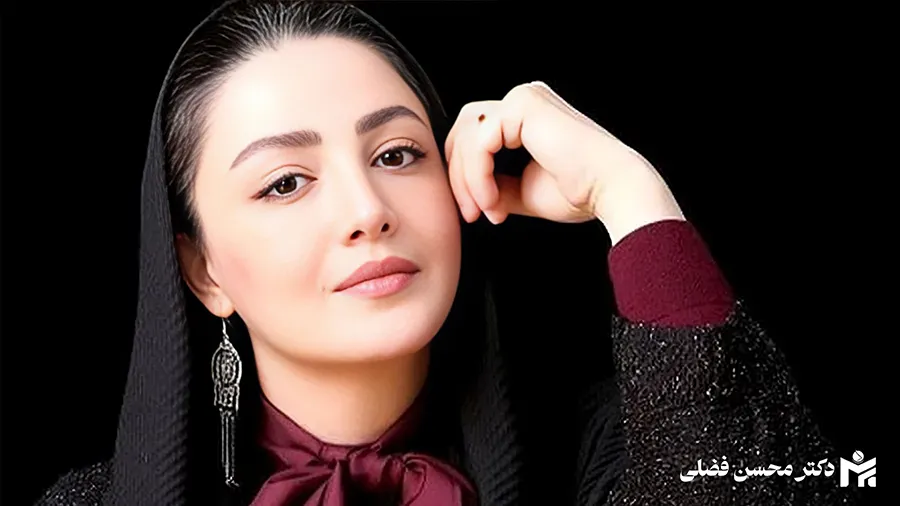 جراحی بینی بازیگران سینما
