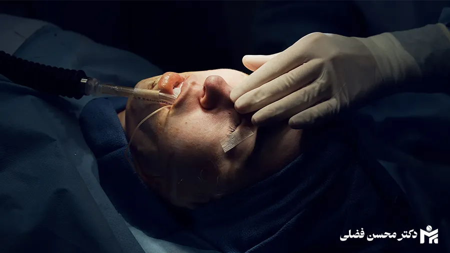 نحوه صحیح خوابیدن بعد از عمل بینی