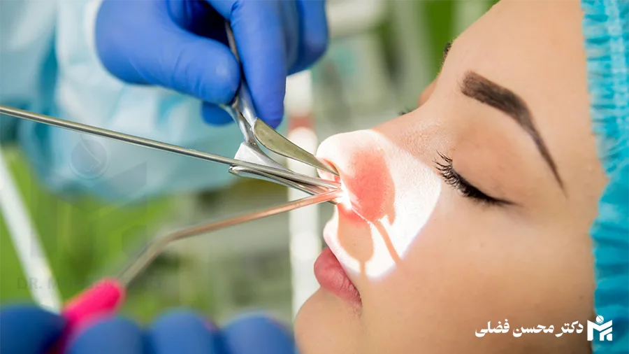 انواع روش های جراحی بینی