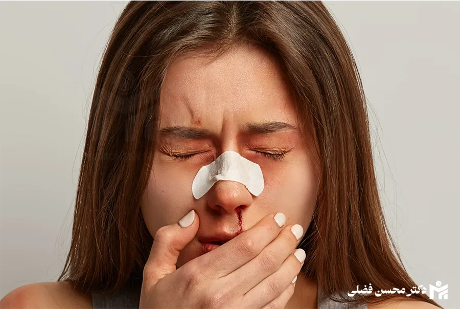 داروهایی که نباید قبل از جراحی بینی استفاده کرد