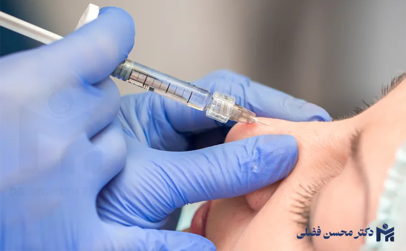 فیلر بینی چیست و با جراحی بینی چه تفاوت هایی دارد؟