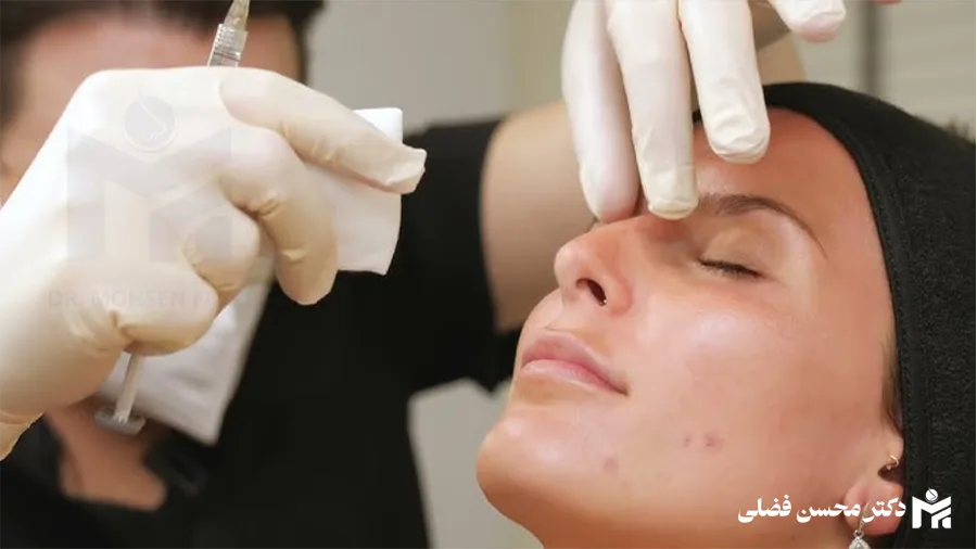 فیلر بینی چیست و با جراحی بینی چه تفاوت هایی دارد؟