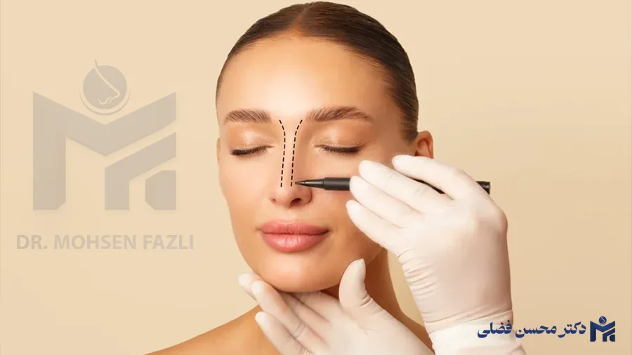 خط کانتور در عمل بینی چیست