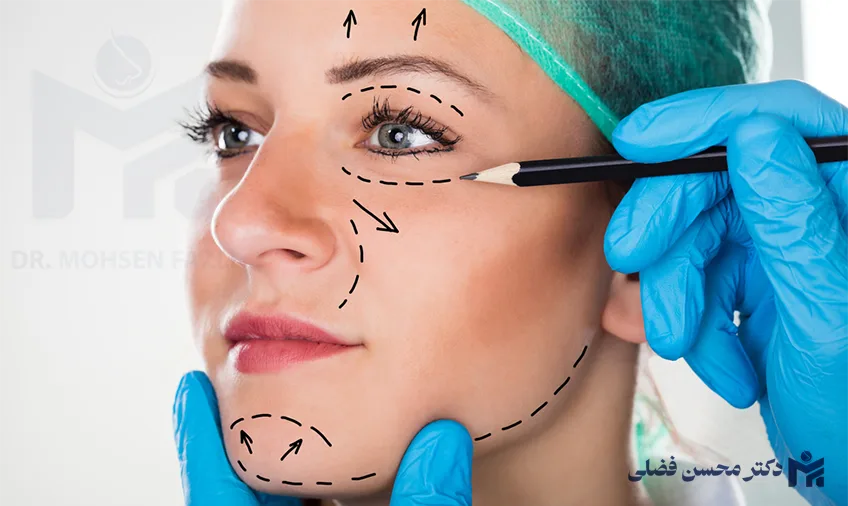 انواع روش های لیفت صورت؛ بهترین آن را بشناسید