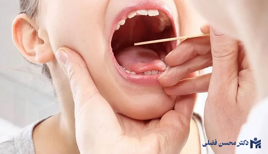 لوزه سوم یا آدنوئید چیست؟! علائم، عوارض و روشهای درمان