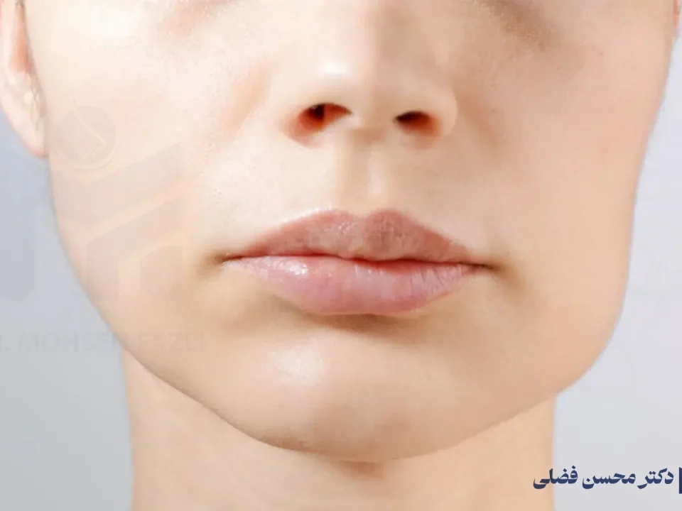 علت ایجاد التهاب یا تومور پاروتید؛ راهنمای جامع تشخیص و درمان