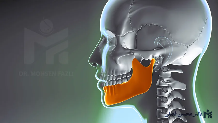 همه چیز درباره جراحی فک؛ انواع، مراحل و نتایج