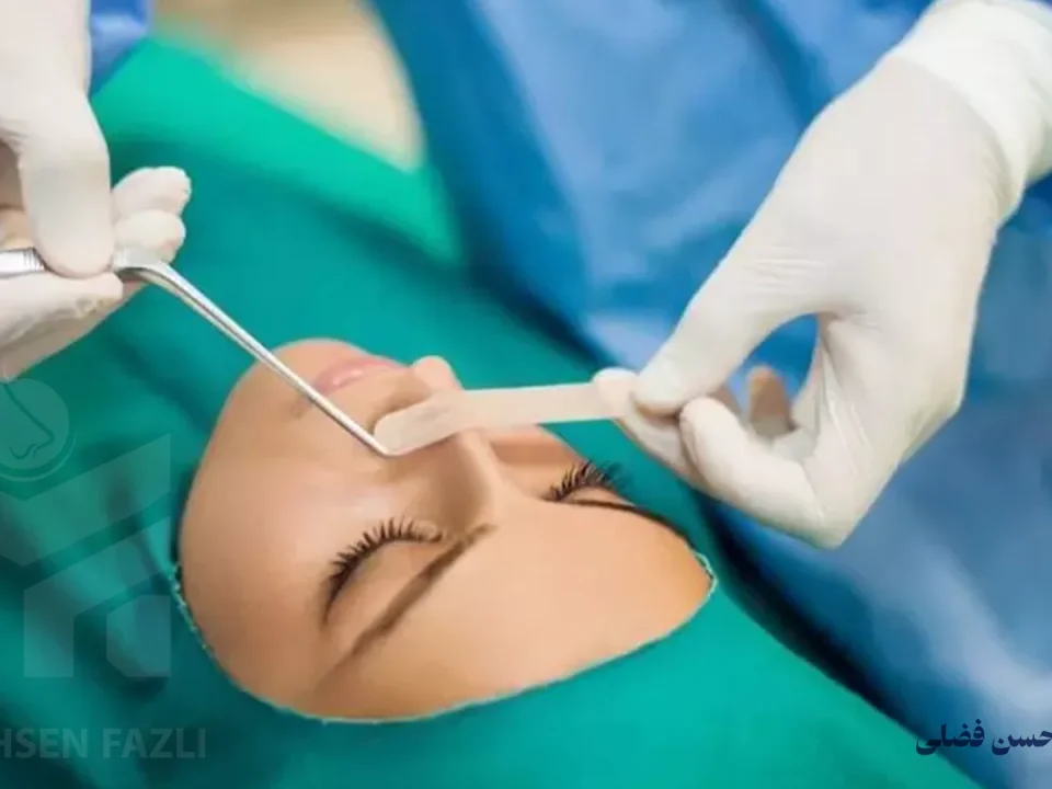 بهترین سن برای عمل بینی چه زمانی است؟