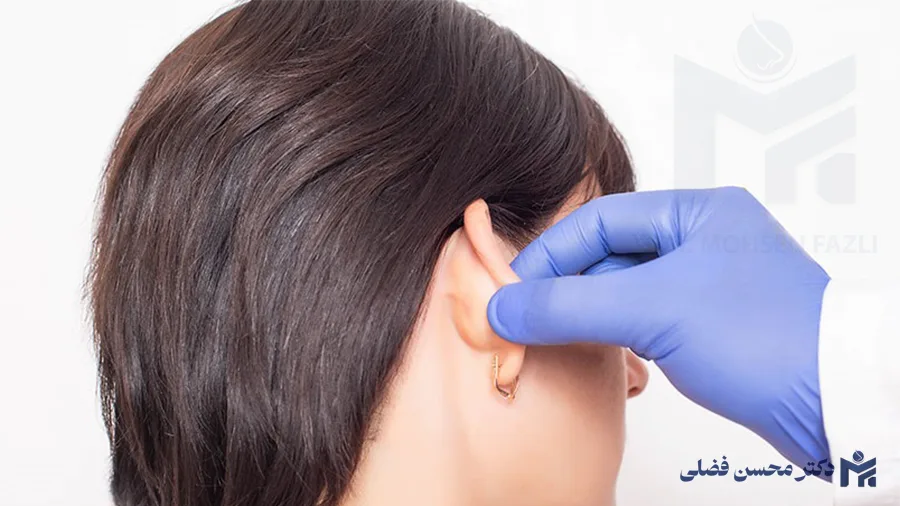 اتوپلاستی چیست؟؛ اصلاح فرم گوش با عمل جراحی