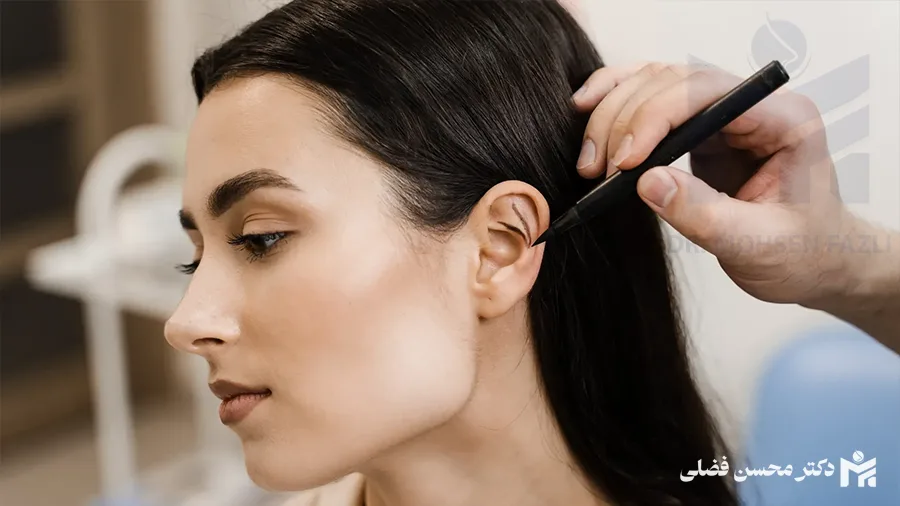 اتوپلاستی چیست؟؛ اصلاح فرم گوش با عمل جراحی