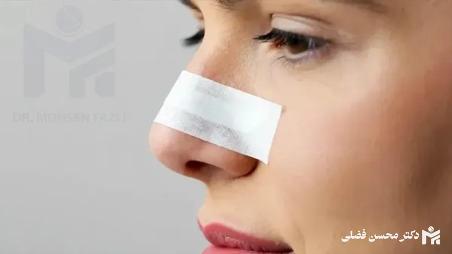 آبریزش بینی بعد از عمل؛ علت، مدت، درمان