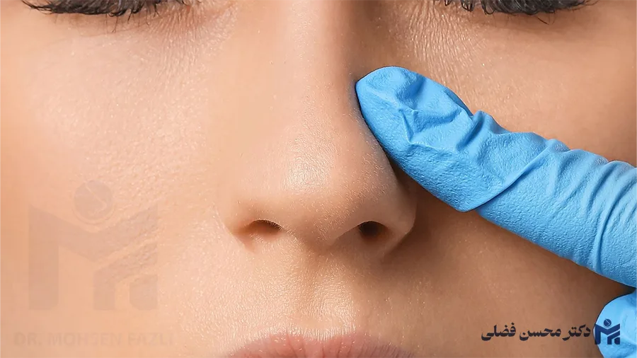 چگونه درد سوزش بینی بعد از عمل را کاهش دهیم؟
