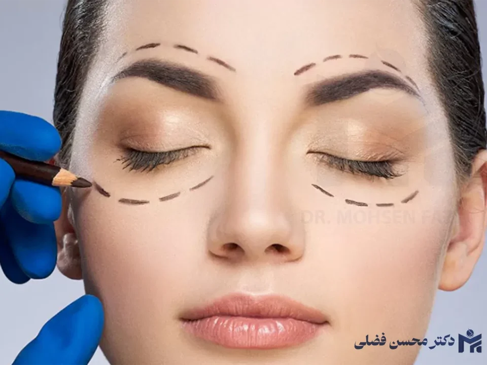 جوان سازی پلک با روش های غیرجراحی