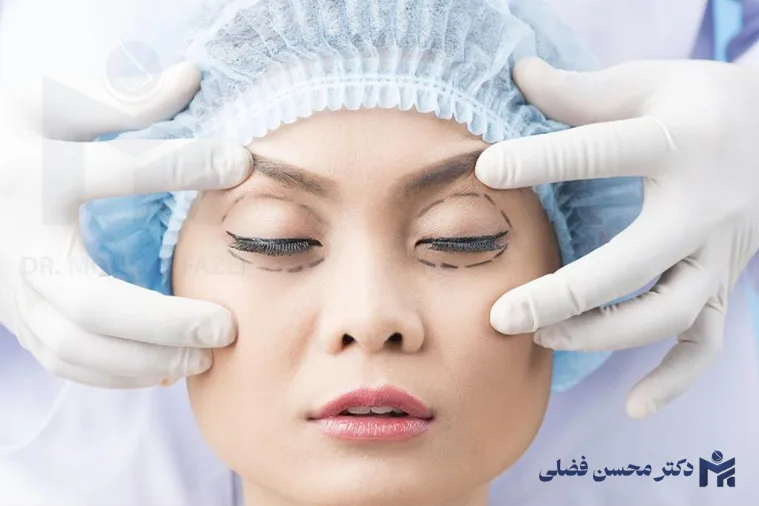 جوان سازی پلک با روش های غیرجراحی