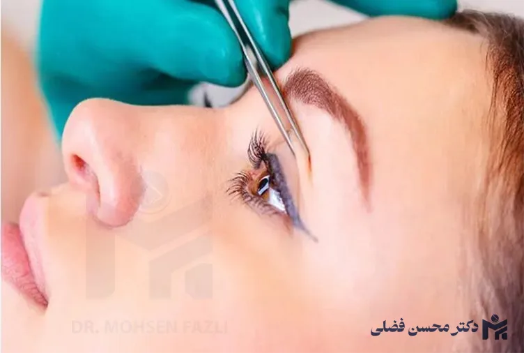 بلفاروپلاستی برای چه سنینی مناسب است؟