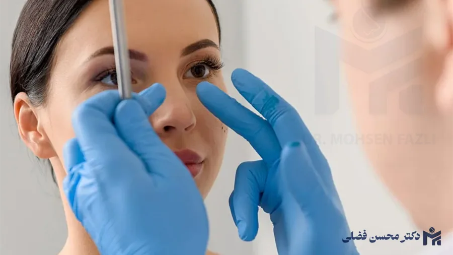 مقایسه عمل بینی گوشتی و استخوانی؛ بینی شما از کدام نوع است؟