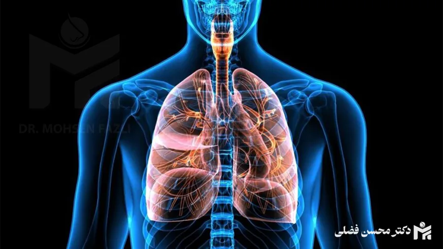 چه بیماری هایی مانع انجام جراحی بینی میشوند