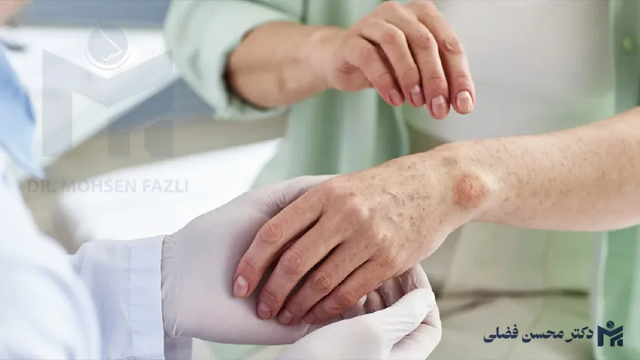 چه بیماری هایی مانع انجام جراحی بینی میشوند