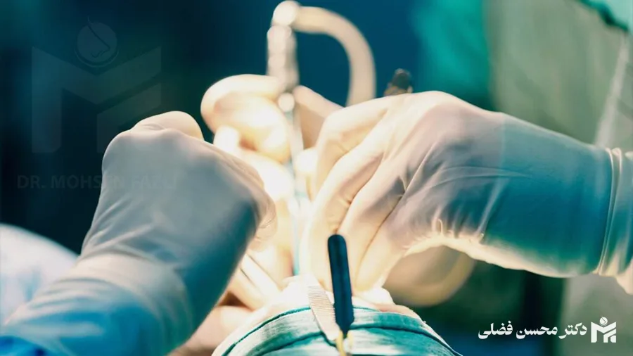 عمل بینی در کرج و نظرآباد