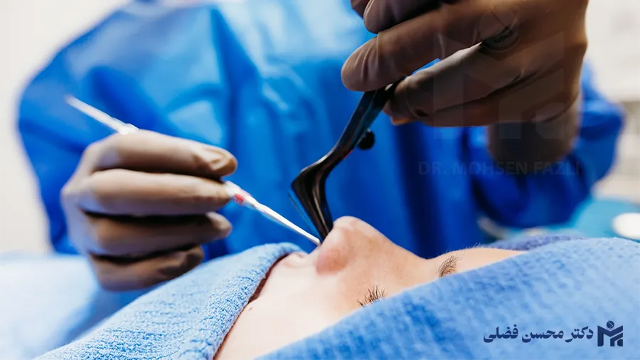 عمل بینی در کرج و نظرآباد